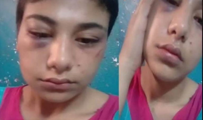  مفاجأة حول “منة عبد العزيز” فتاة التيك توك بعد تقرير الطب الشرعي