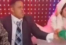 متلازمة داون