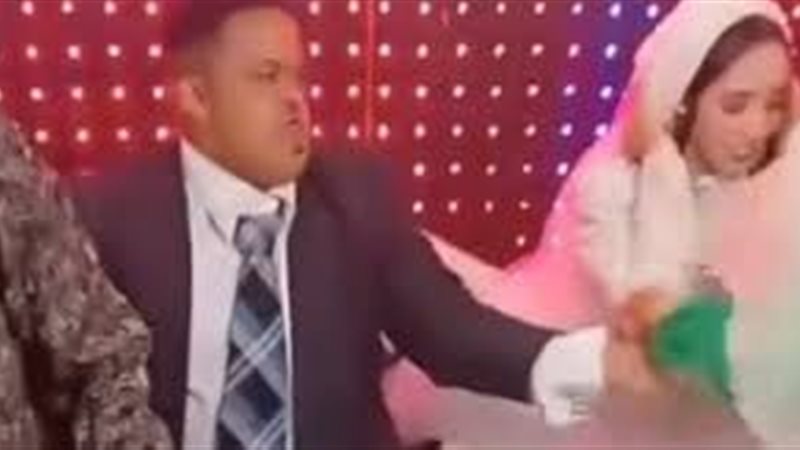 متلازمة داون