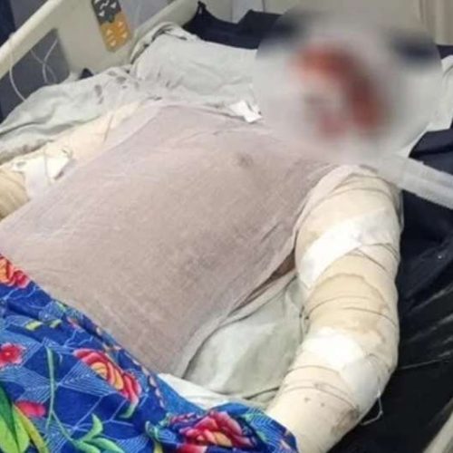 بطل حريق شبرا الخيمة