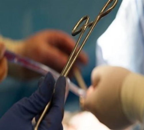 تجارة الأعضاء