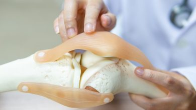 علاج انضغاط الأعصاب
