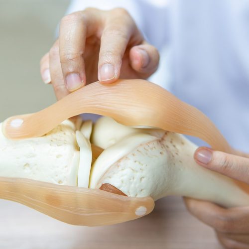 علاج انضغاط الأعصاب